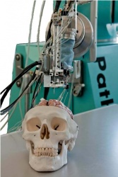 Targeting of a brain-skull phantom with a multi-robotic chain (NearLab).